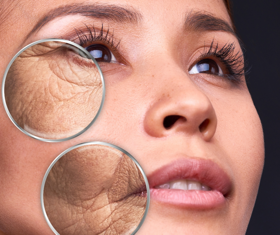 Aging Skin
